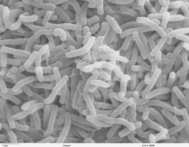 Bactérie Vibrio cholerae dans l'intestin d'un malade du choléra. Notre tube digestif recèle nombre de bactéries inoffensives © DR Bactérie Vibrio cholerae dans l'intestin d'un malade du choléra. Notre tube digestif recèle nombre de bactéries inoffensives © DR